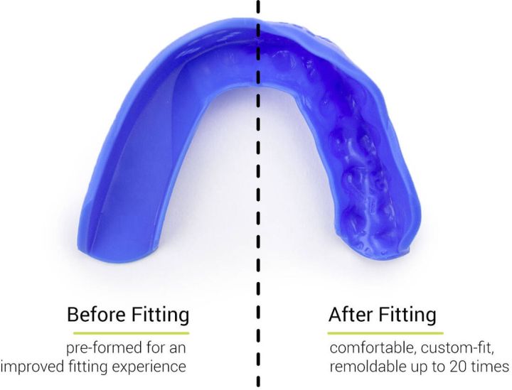 Ochraniacze Na Zęby Sisu 3D Royal Blue